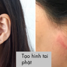 Tạo hình tai phật