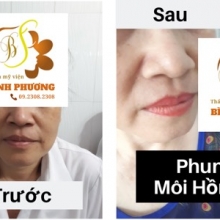 Phun môi hồng